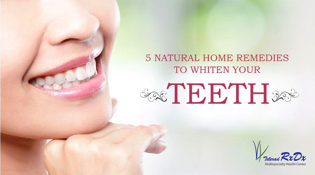 5 Natural home remedies to whiten your teeth