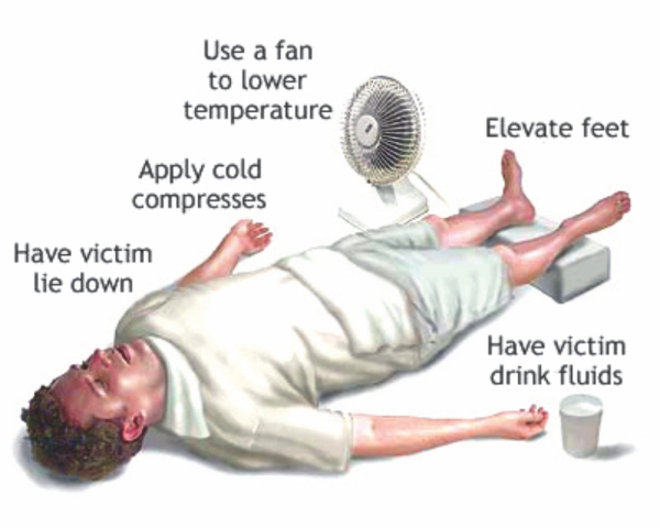 Heat Stroke-RxDx-First-aid