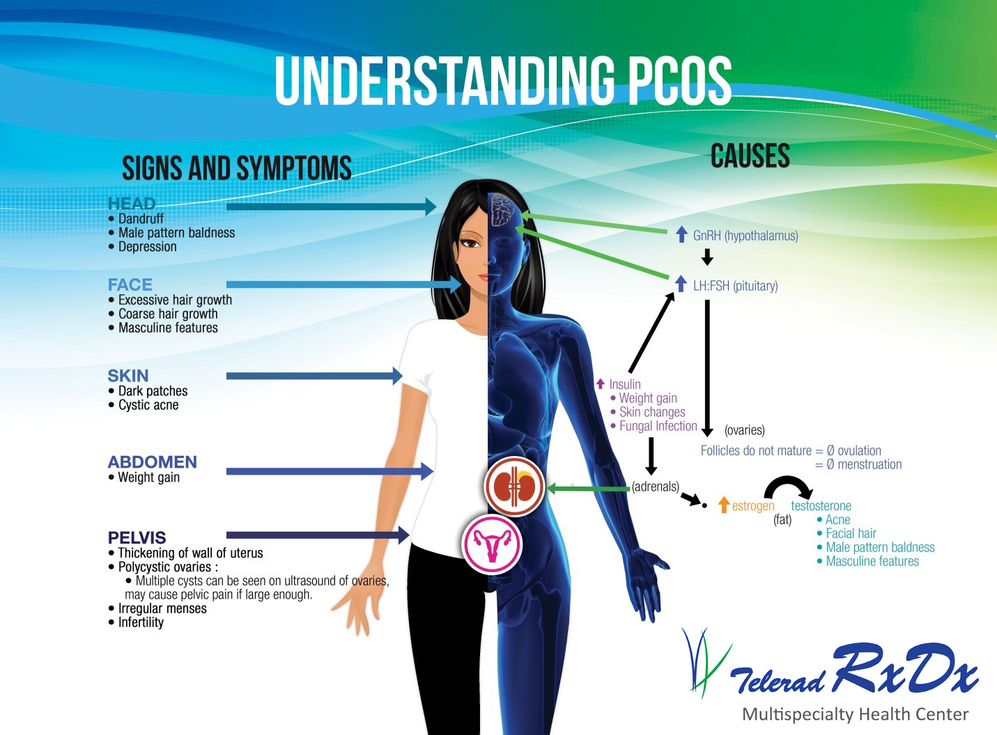 Think You Have PCOS Understand PCOS Risks Symptoms Complications 