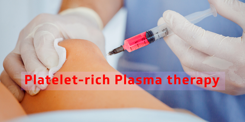 Prp Or Platelet Rich Plasma Therapy How Effective Is It 