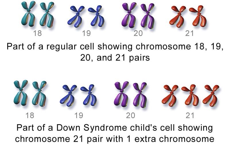 down syndrome genes