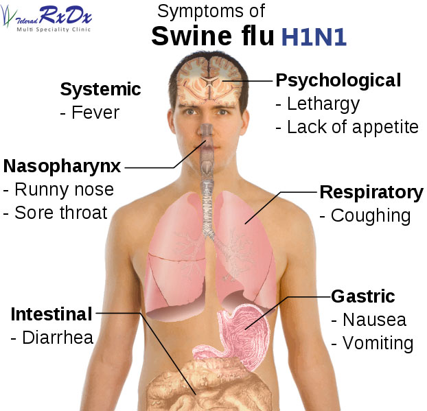 h1n1-swine-flu-symptoms-rxdx-healthcare