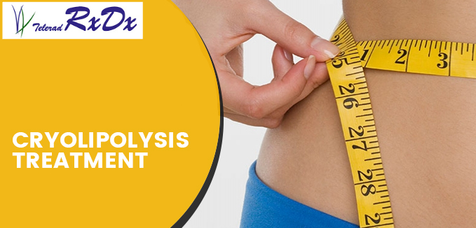 Cryolipolysis