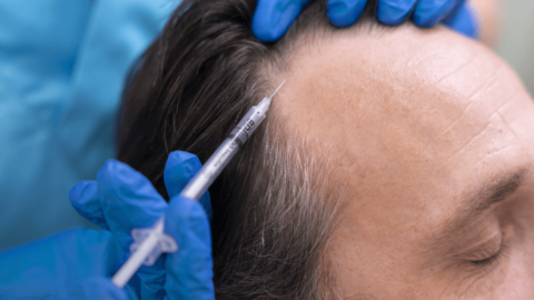 GFC treatment for hair | GFC for Skin in Bangalore | RxDx