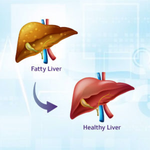 Fatty Liver Reversal Program