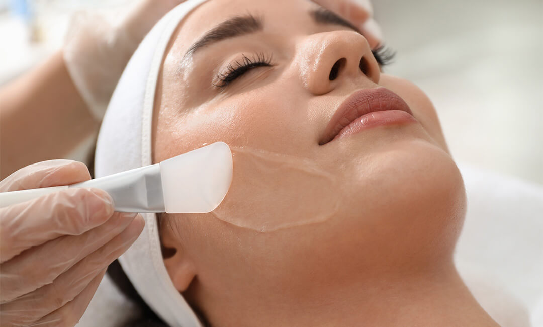 cosmetic-peels Chemical Peel