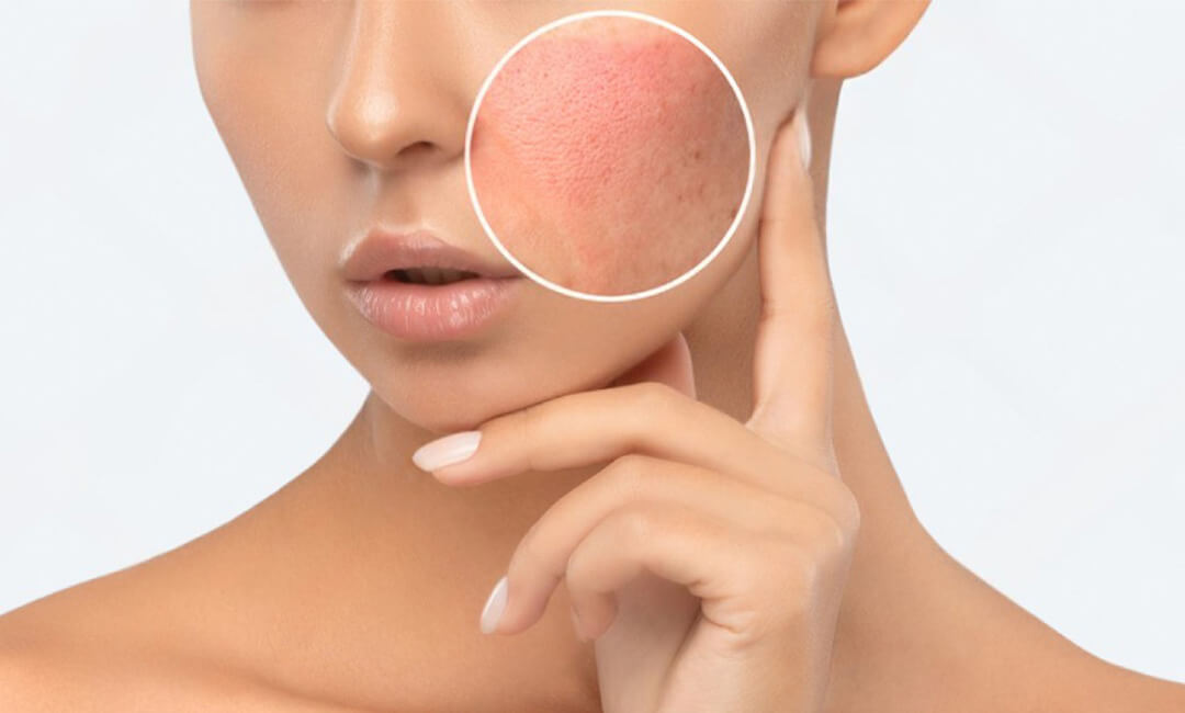 face-side-effects Side Effects