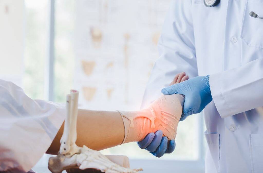 Ankle Sprain