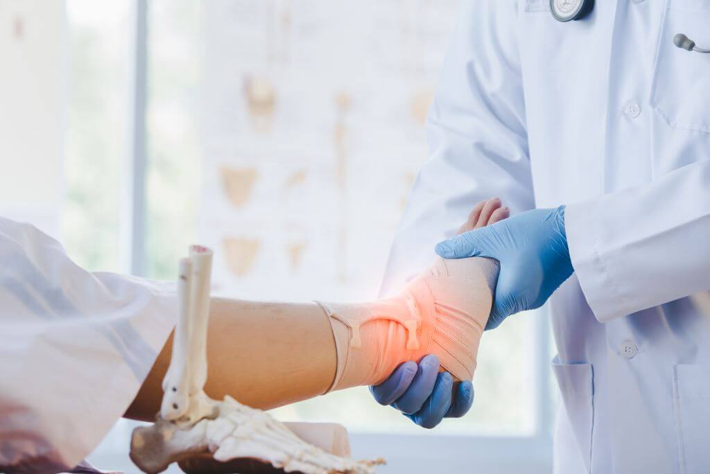 Ankle Sprain: How a Physiotherapist Can Help