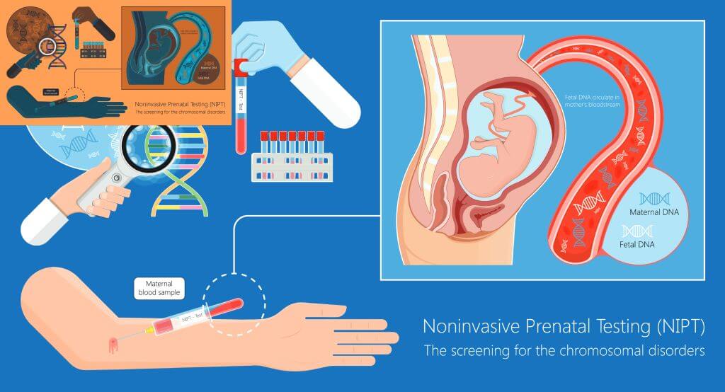 What is NIPT? A Complete Guide to Non-Invasive Prenatal Testing