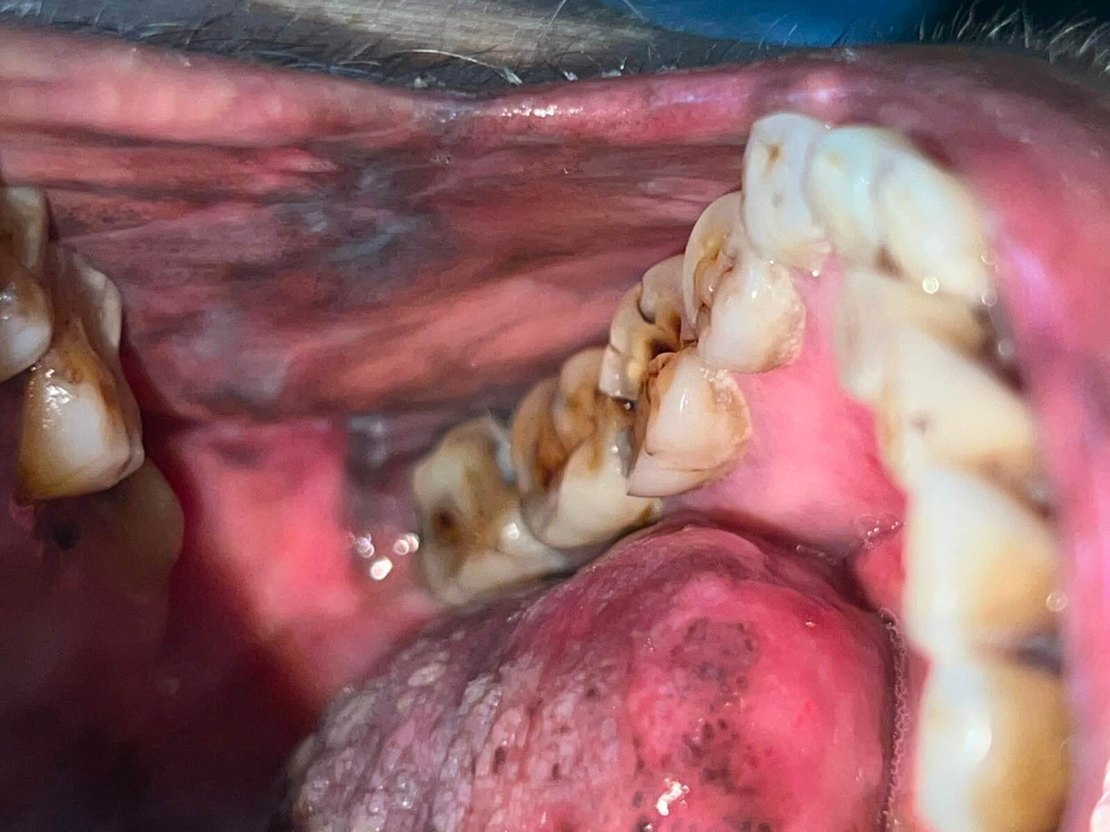  lichen planus affect areas