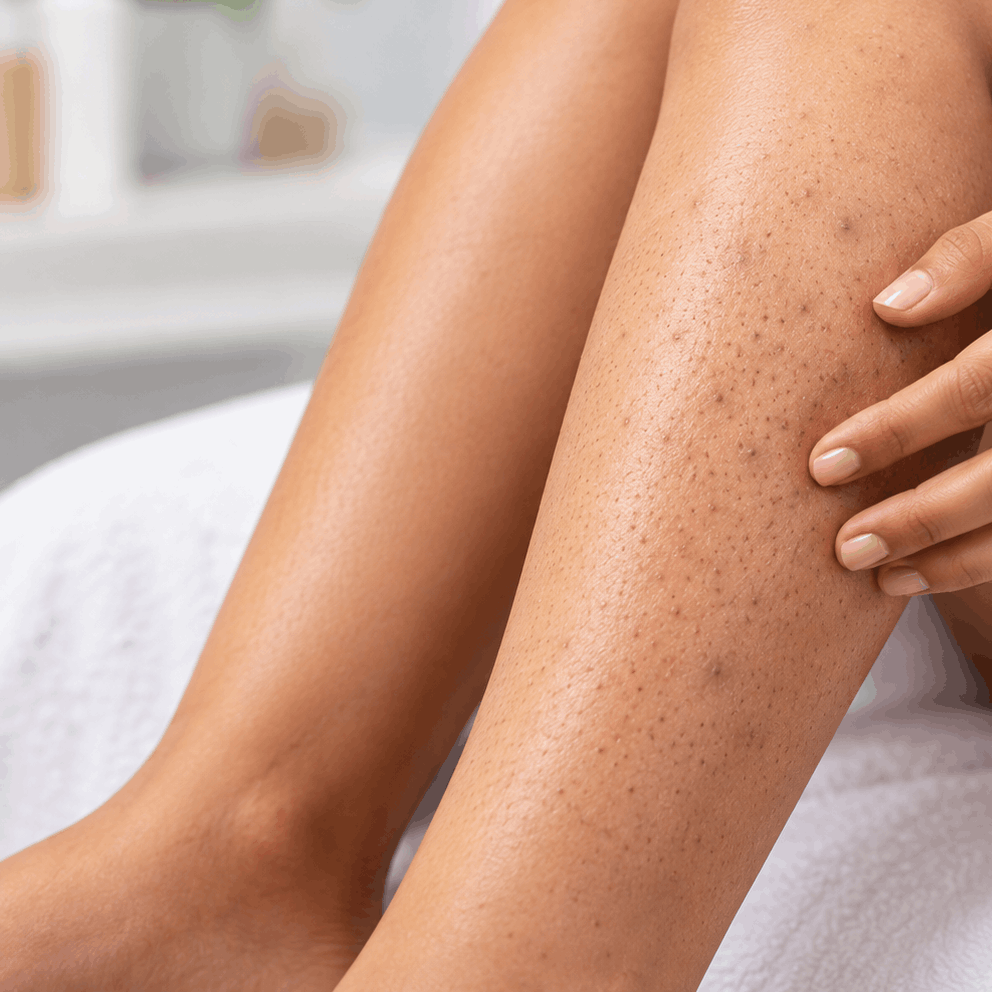 ingrown hairs or pigmentation